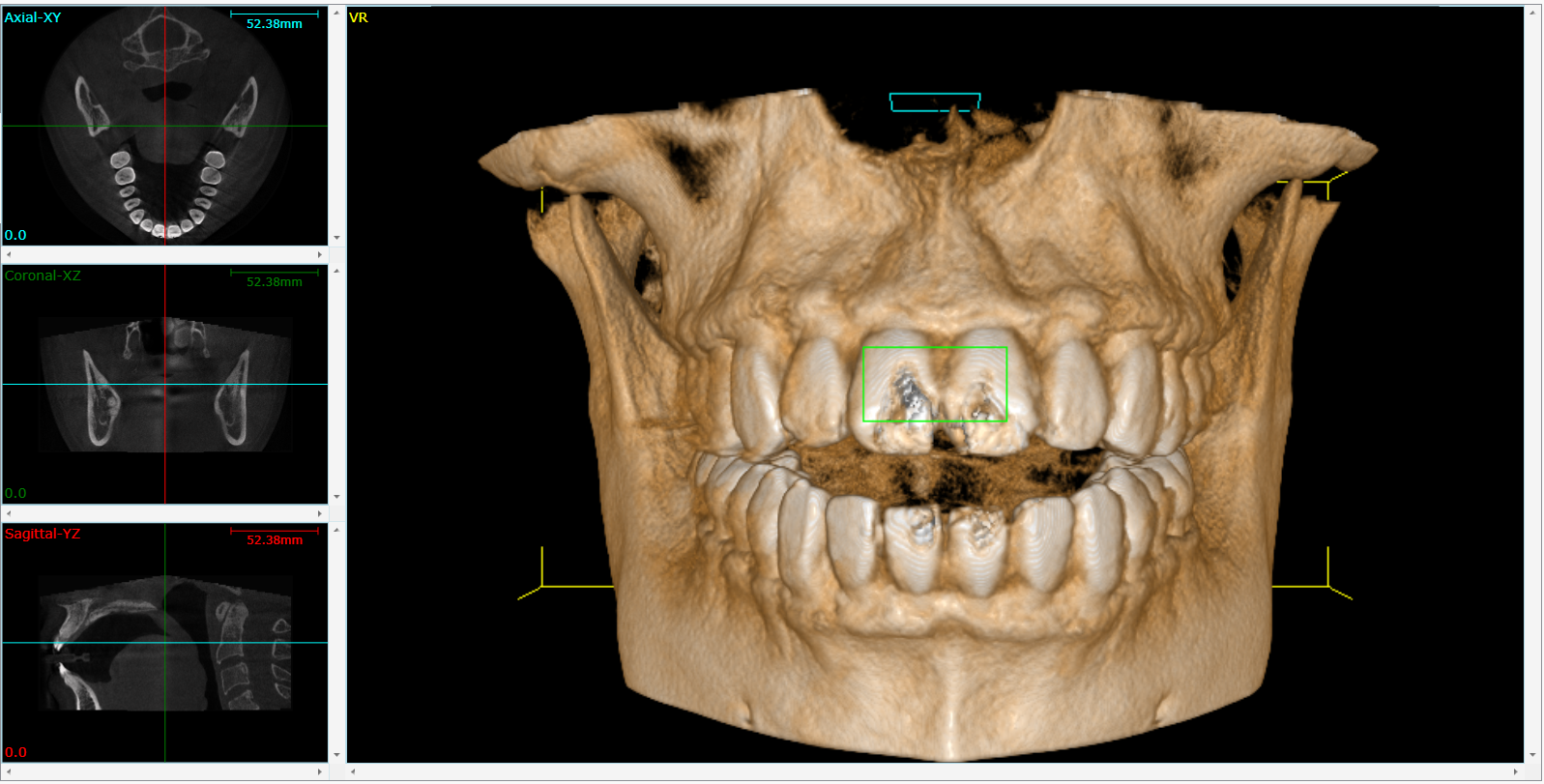 Cone Beam 3D Imaging Clinton Township, MI