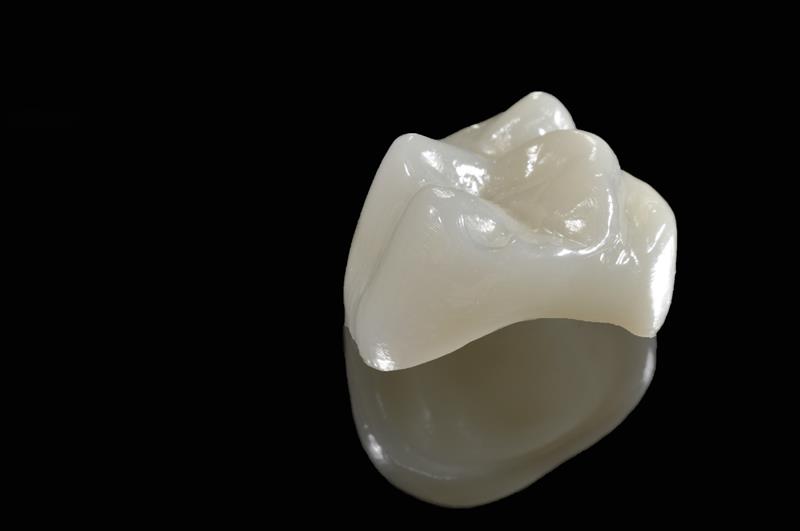 Porcelain Crowns Clinton Township, MI